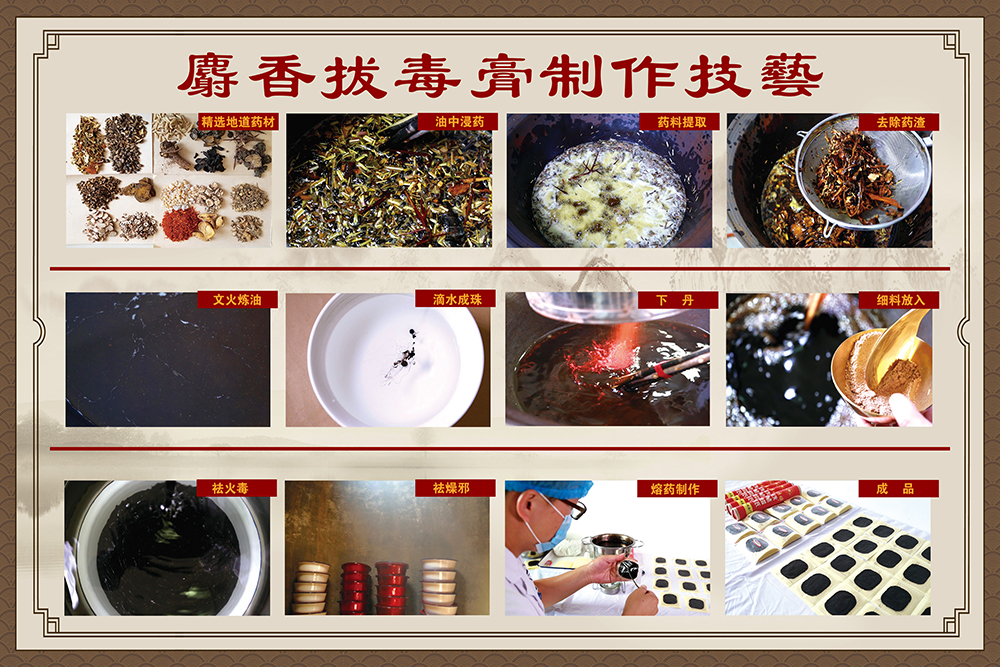 把“非遗名医”请回家:无码破解
上门服务,让重度褥疮患者重获新生